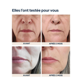 Cure Peau repulpée cuutume.com 1