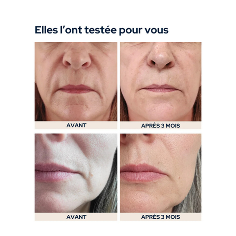 Cure Peau repulpée cuutume.com 1